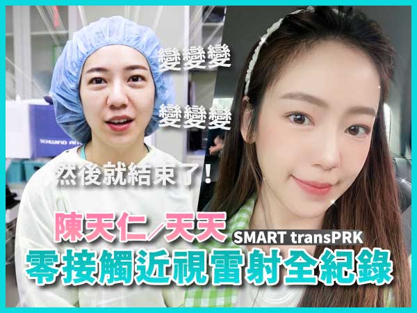 天天陳天仁零接觸近視雷射全紀錄SMART transPRK