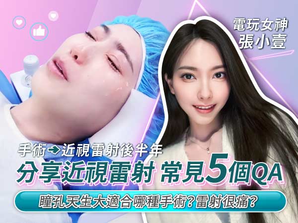 電玩女神張小壹眼睛雷射手術5個常見Q&A
