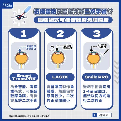 近視雷射是否能允許二次手術呢