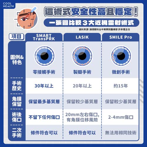 SMART TransPRK近視雷射安全性高且穩定