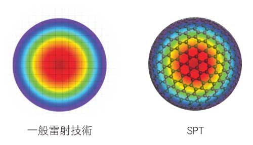 SmartPulse(SPT)技術