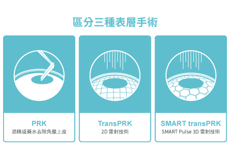 區分三種表層近視雷射SMARTtransPRK、transPRK、PRK